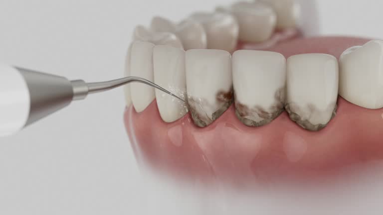 Trusted Teeth Cleaning And Checkup service in East Vineland, NJ - Dentist Open Now